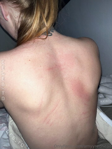 Amy Redhead nude photo 10