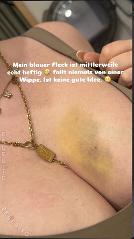 Die Meedtis nude photo 6