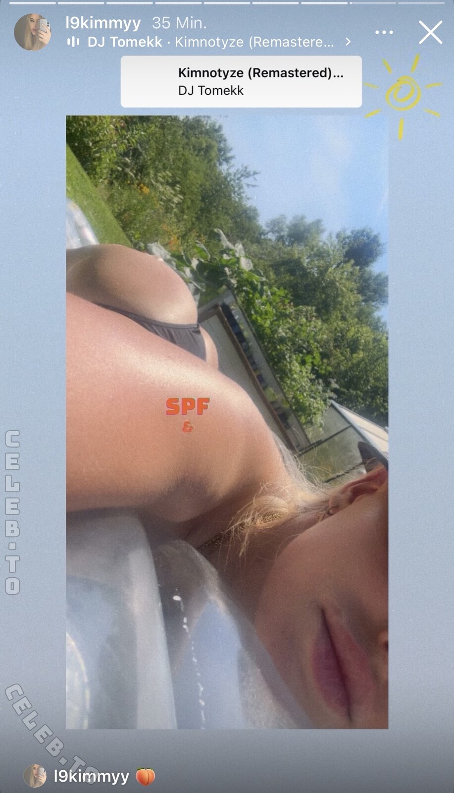 l9Kimmy nude photo 7