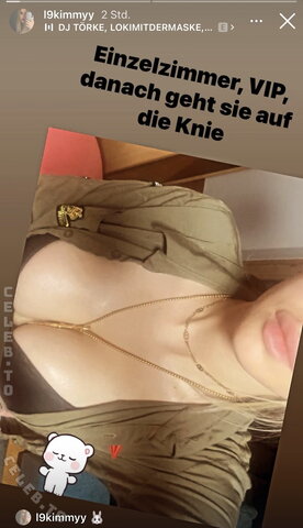 l9Kimmy nude photo 8