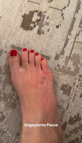 Lea Katharina Maria – Unplanned break? Unplanned feet!