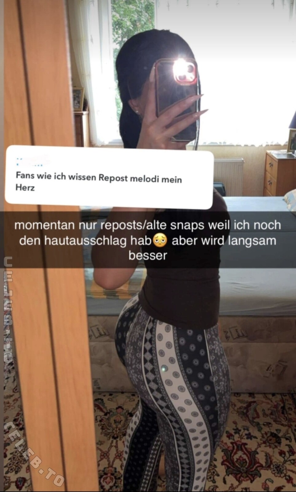 melodi.mzd nude photo 1