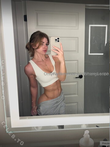 Scoliosis.soph nude photo 9