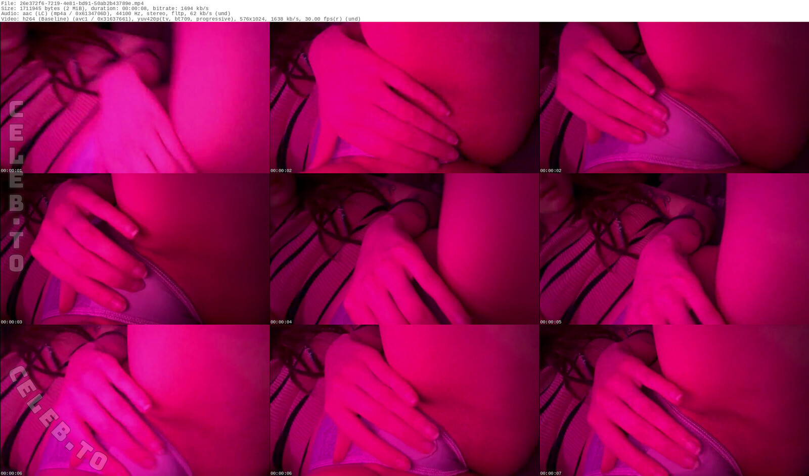SinonSkinn nude photo 3