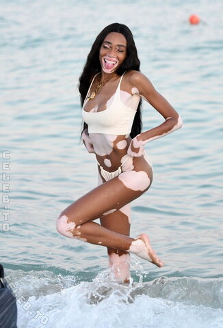 Winnie Harlow nude
