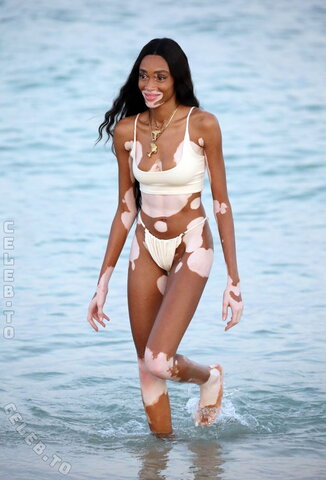 Winnie Harlow nude