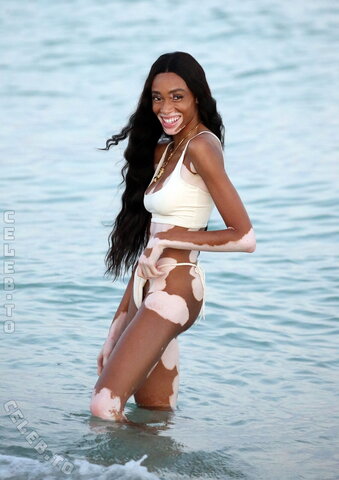 Winnie Harlow nude