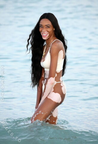 Winnie Harlow nude