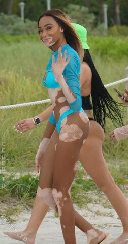 Winnie Harlow nude