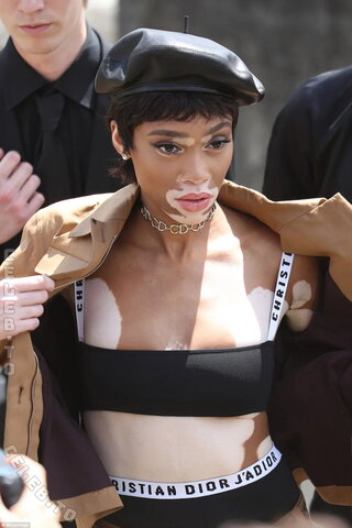 Winnie Harlow nude photo 5