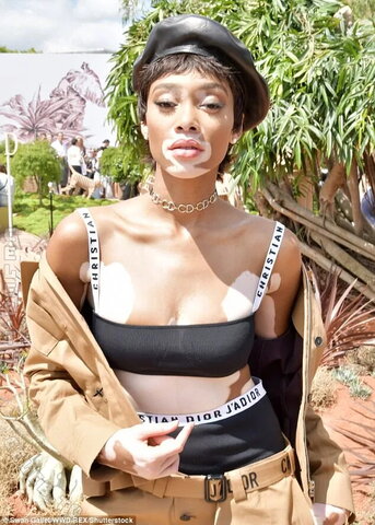 Winnie Harlow nude photo 3