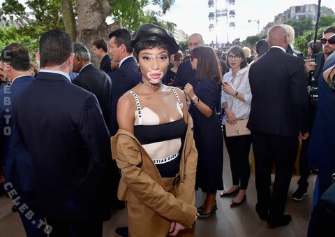 Winnie Harlow nude photo 1