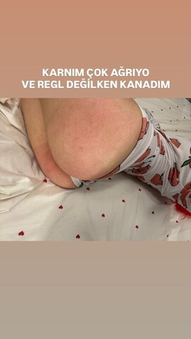 Zeynepiksy . Zeynep nude photo 2