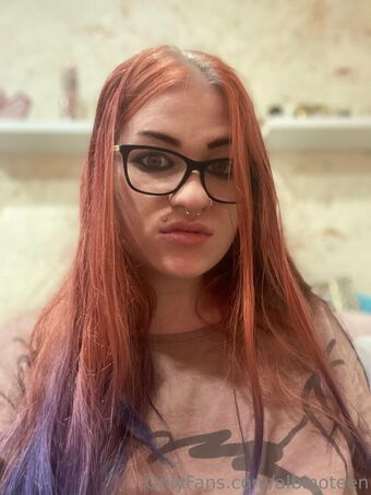 Albinoteen Nude Leaks OnlyFans Photo 24