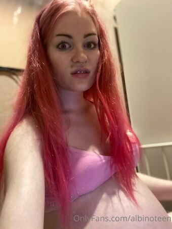 Albinoteen Nude Leaks OnlyFans Photo 17