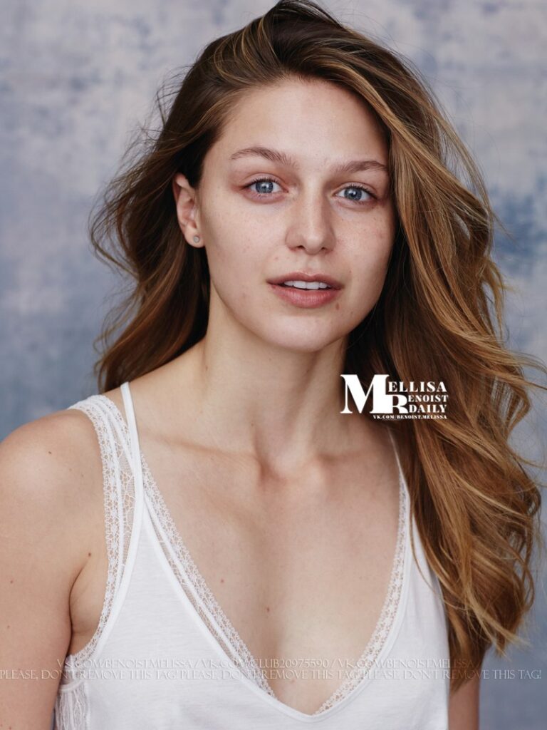 Celeb – Melissa Benoist – Nude