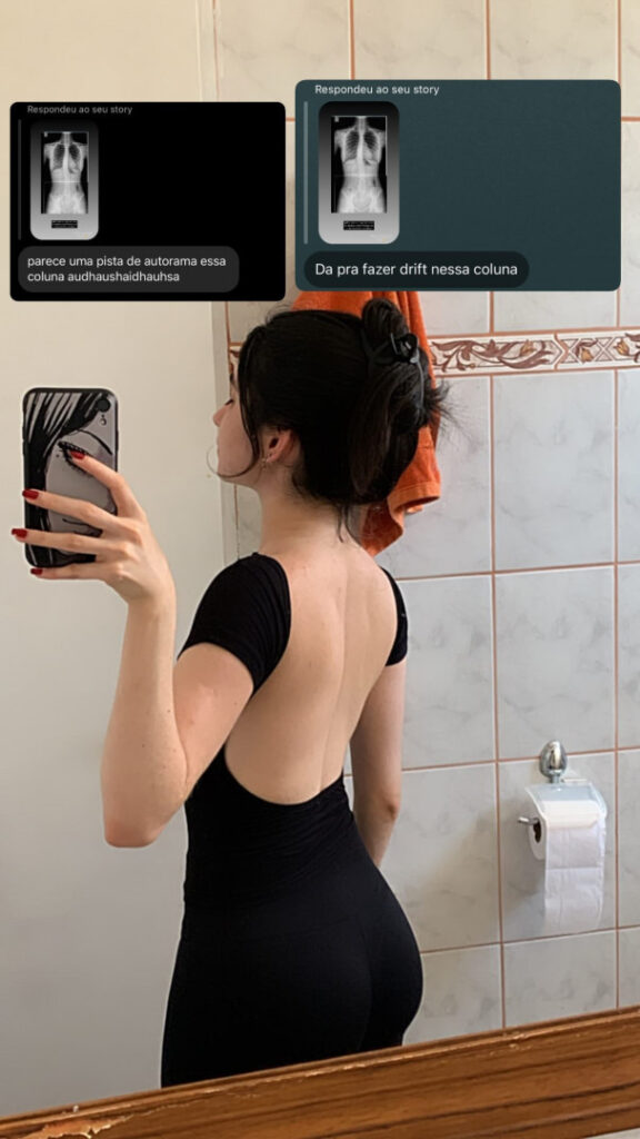 Brazil – Twitch – Ilamie / Lamie / Larissacarvalhx – Nude Leaks