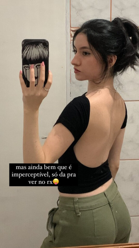 Brazil – Twitch – Ilamie / Lamie / Larissacarvalhx – Nude Leaks