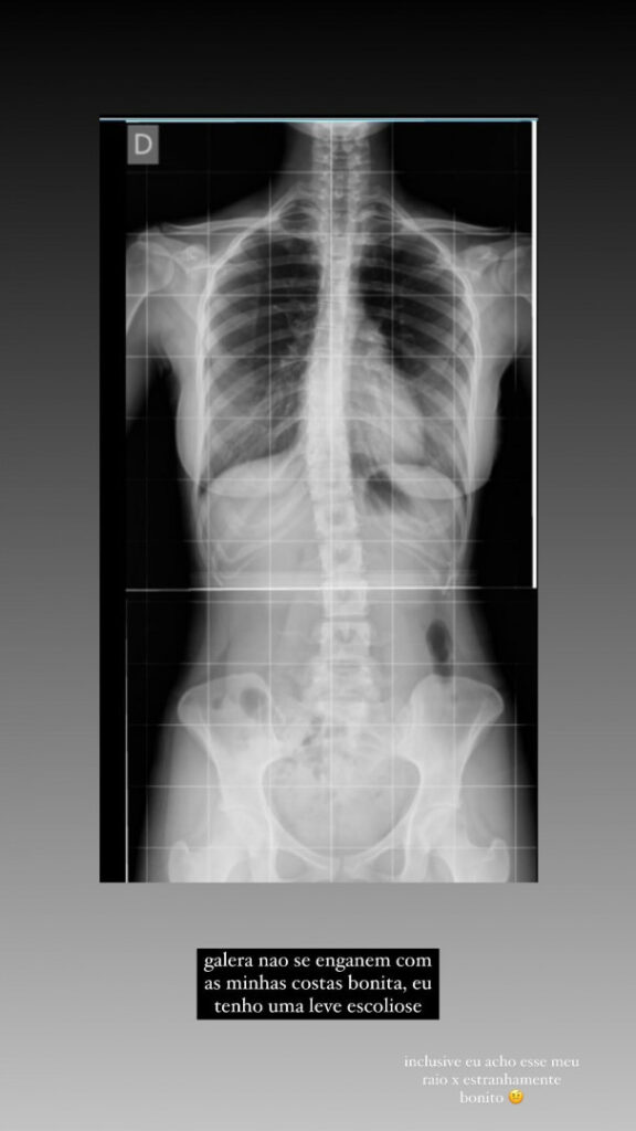 Brazil – Twitch – Ilamie / Lamie / Larissacarvalhx – Nude Leaks