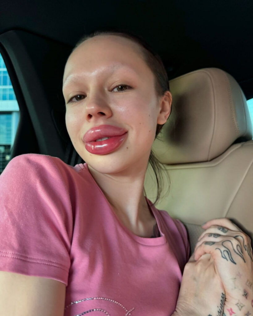 Instagram – Instasamka – Nude