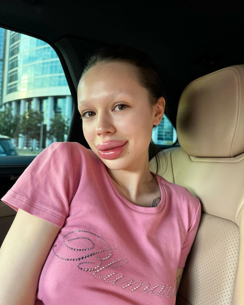 Instagram – Instasamka – Nude