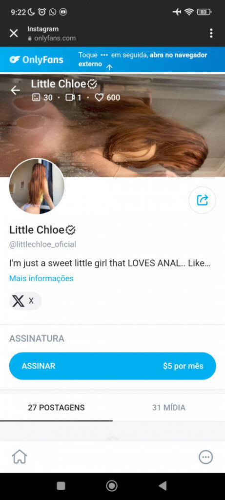 OnlyFans – littlechloe_oficial – Nude Leaks