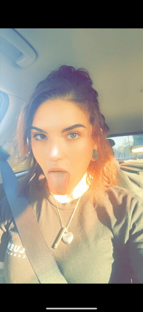 Sunnysuicide666 – Nude Leaks