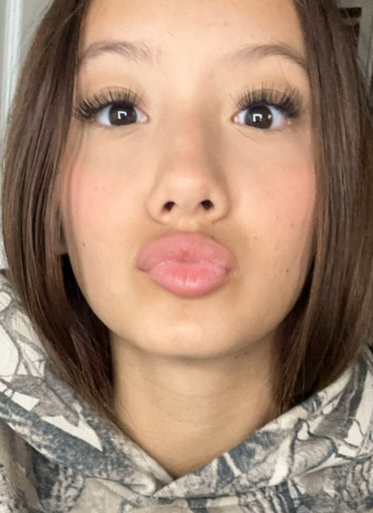 Instagram – Teen – Alessandra Liu – Nude Leaks