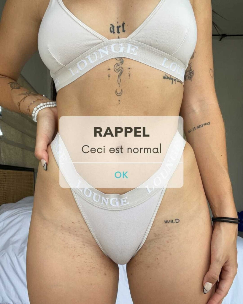 Youtube – Alohalaia – Nude Leaks