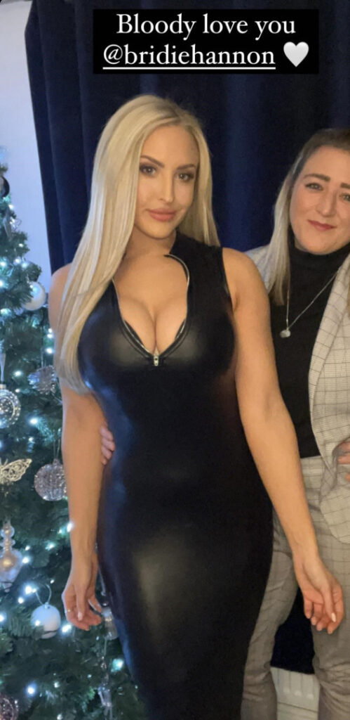 Instagram – Emma Louise Jones (eljonesuk) – Nude Leaks