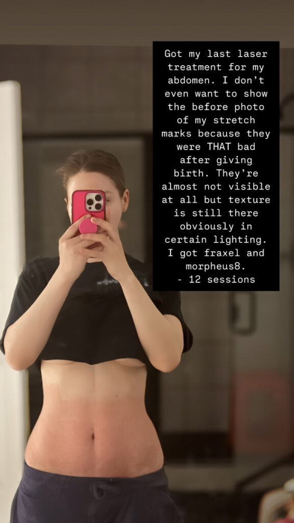 OnlyFans – Instagram – Izzy G (pnkysparkles) – Nude