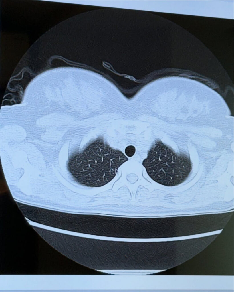 Instagram – Asian – Jun Amaki – Nude