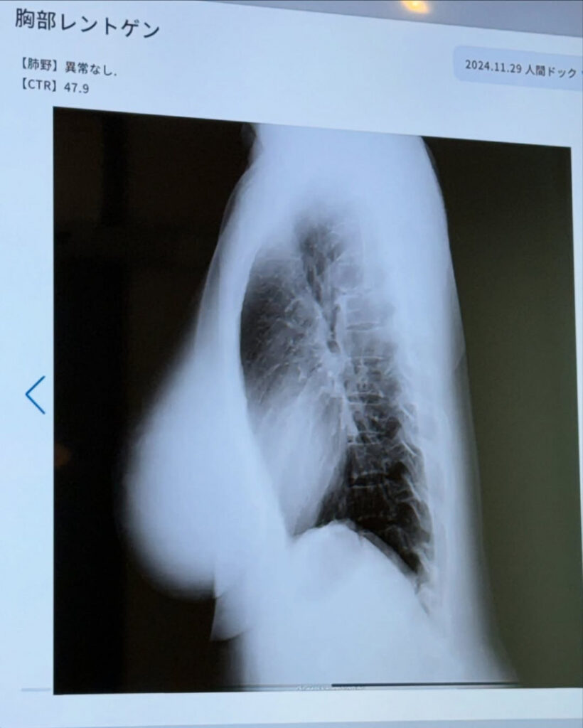 Instagram – Asian – Jun Amaki – Nude