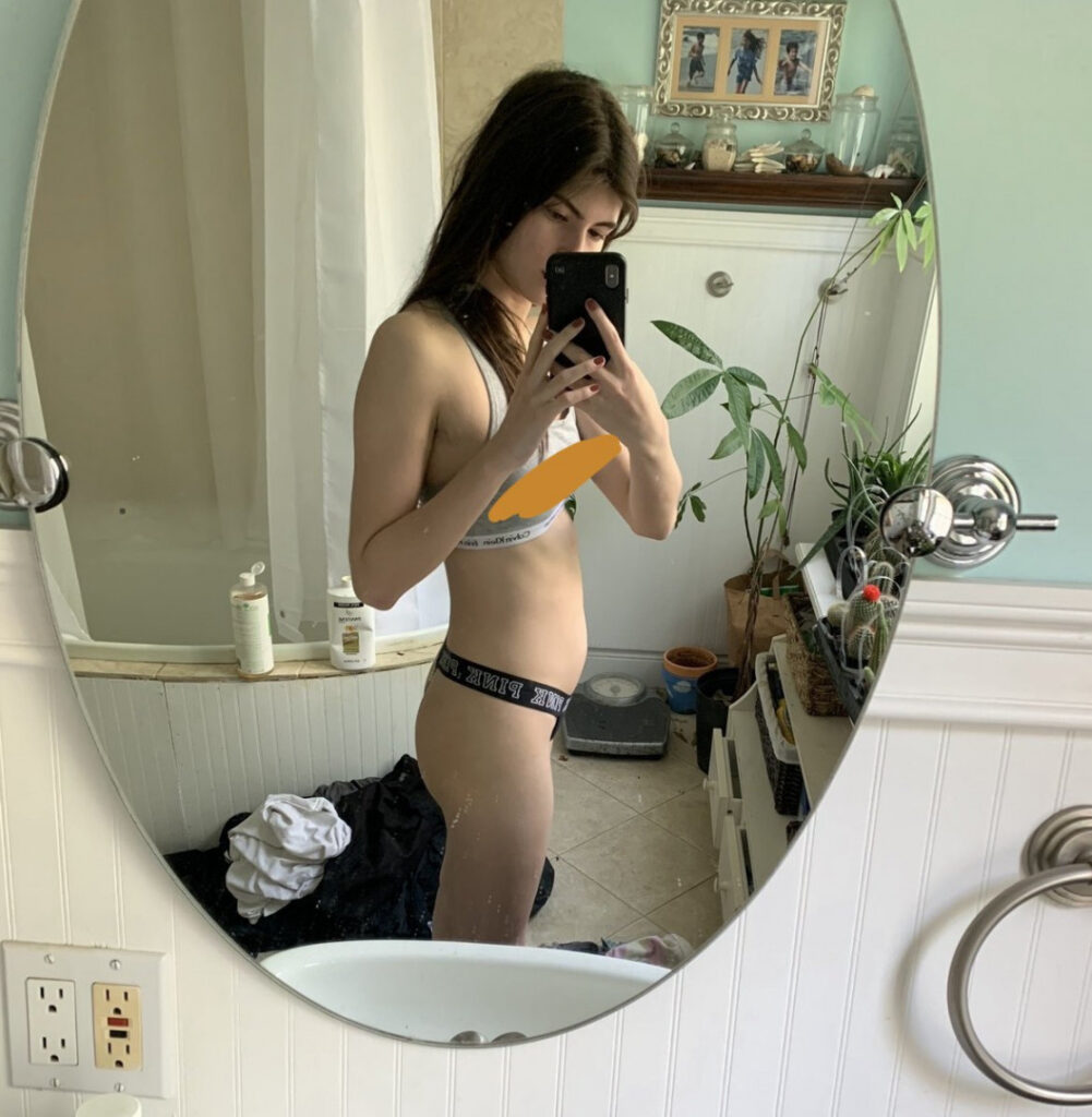 Twitch – RawrReeXD / Rorey – Nude