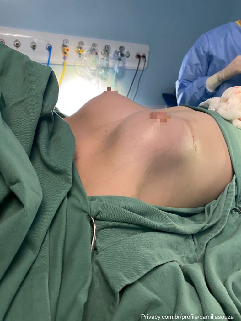 Brazil – Privacy – Camis Souza – Nude Leaks