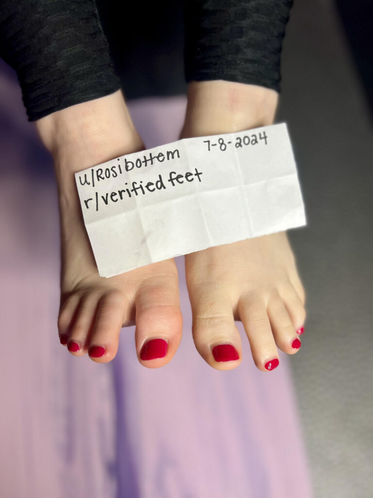 Reddit – Rosi-Bottem – Nude Leaks