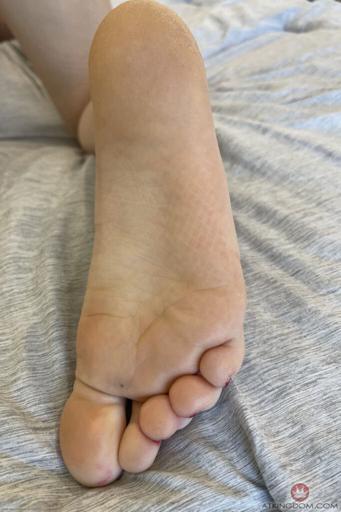 Fiona Sprouts – Nude Leaks Onlyfans