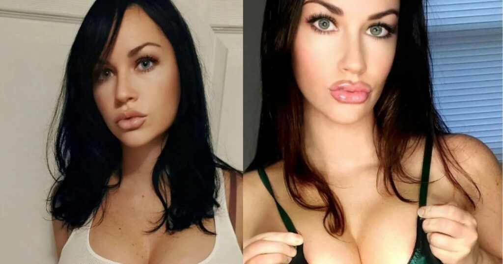 Amy Kupps / amykupps93 – Nude Leaks Onlyfans