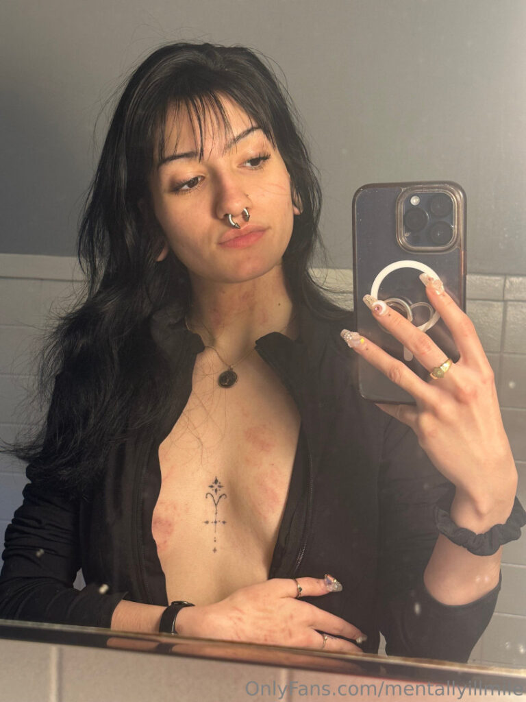 Mentallyillmile – Nude Leaks Onlyfans